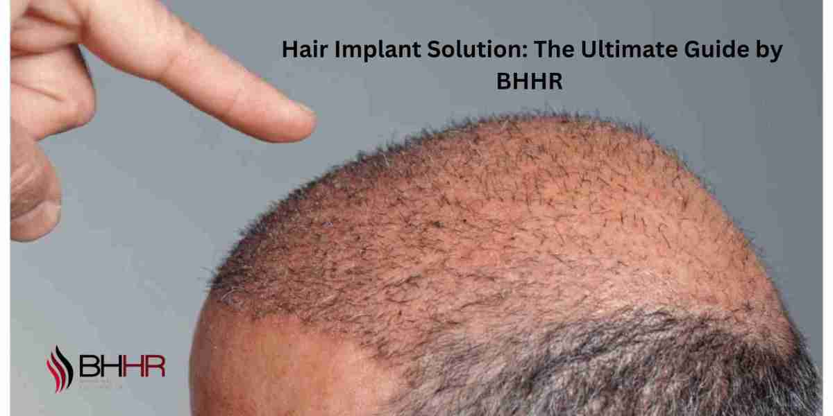 Hair Transplant Solutions: The Ultimate Guide to Restoring Your Hair