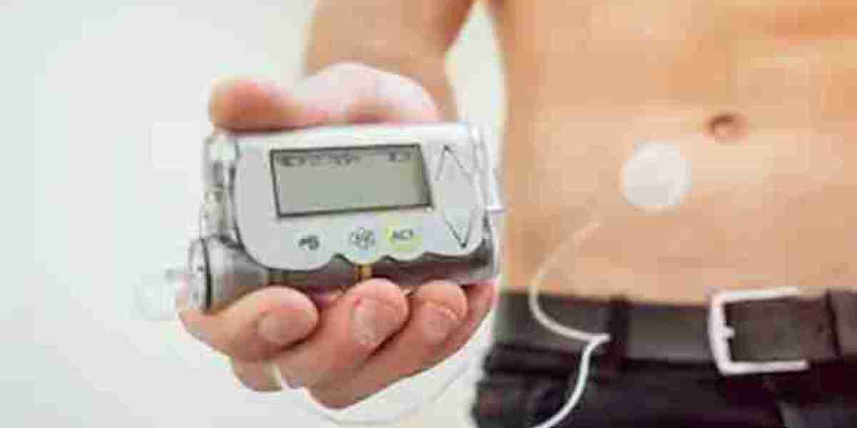 India Insulin Pumps Market Report & Forecast 2032