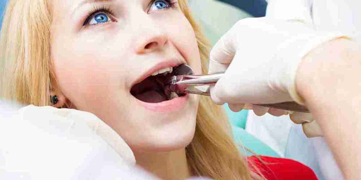 Everything You Need to Know About Tooth Extraction in Las Vegas: Procedure, Recovery, and Care