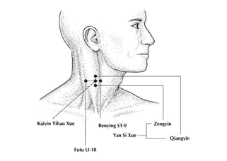 spasmodic dysphonia cure