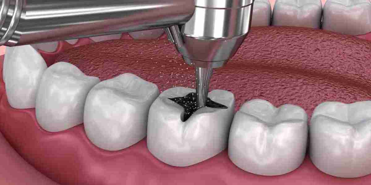 Tooth Filling Materials Market: Exploring the Role of Patient Demographics in Shaping Market Demand