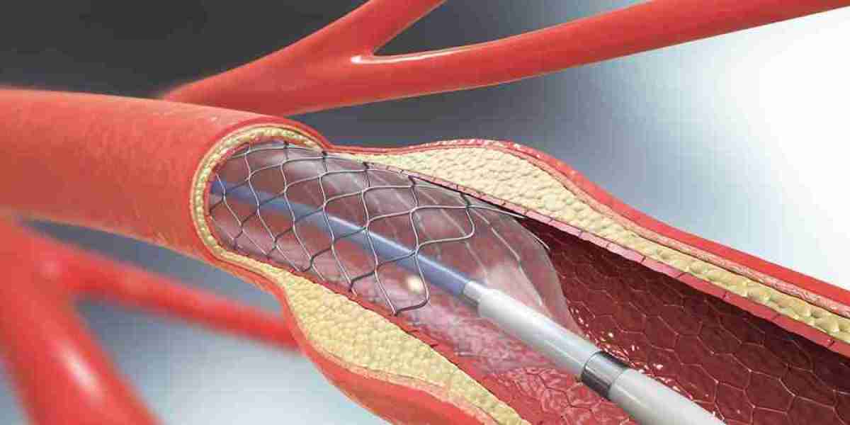 Angioplasty Balloons Market: Collaboration Between Manufacturers and Healthcare Providers to Improve Outcomes