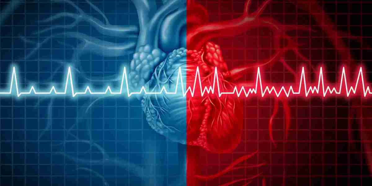 Atrial Fibrillation (Afib) Market: How the Future of Afib Care is Shaped by Emerging Trends