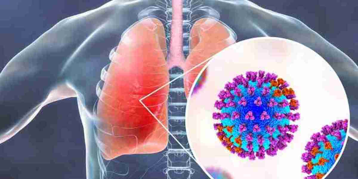 Respiratory Syncytial Virus (RSV) Diagnostics Market Opportunities: Evaluating Growth Prospects Across Emerging Regions