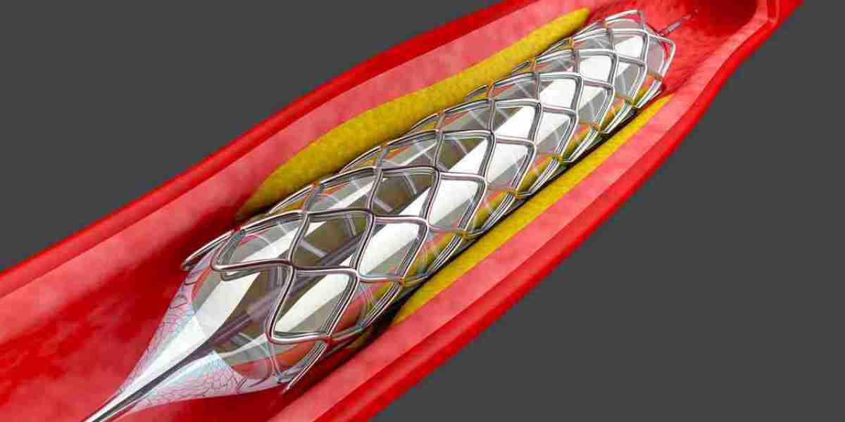 Angioplasty Balloons Market Impact: Exploring the Influence of Technological Innovations and Healthcare Policies