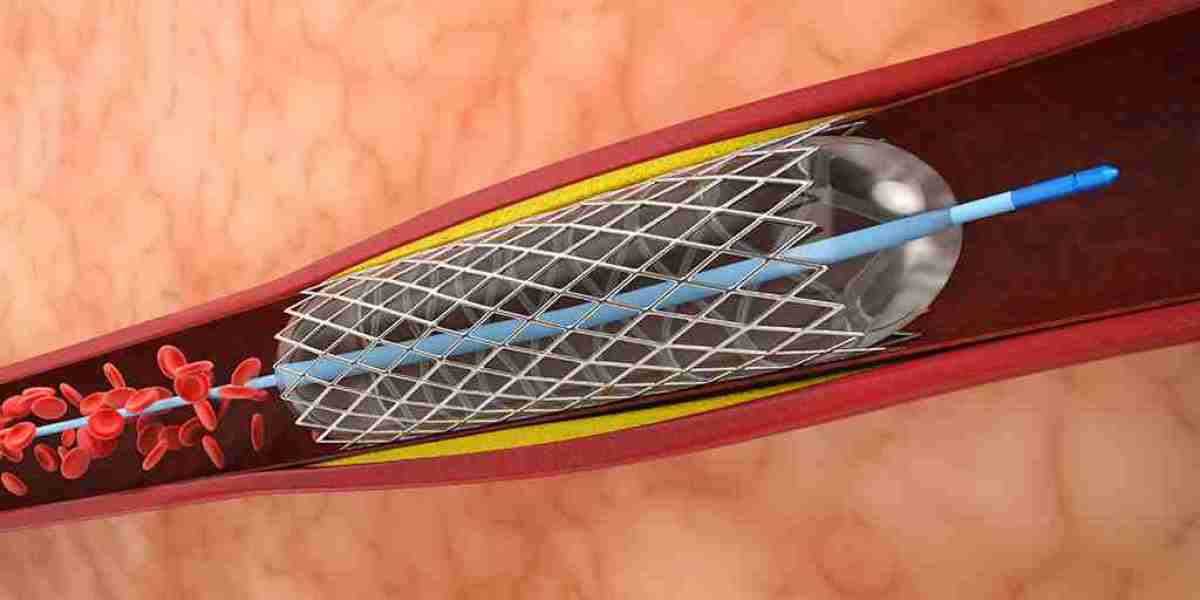 Angioplasty Balloons Market Innovations: Focus on Drug-Coated and Cutting-Edge Balloons