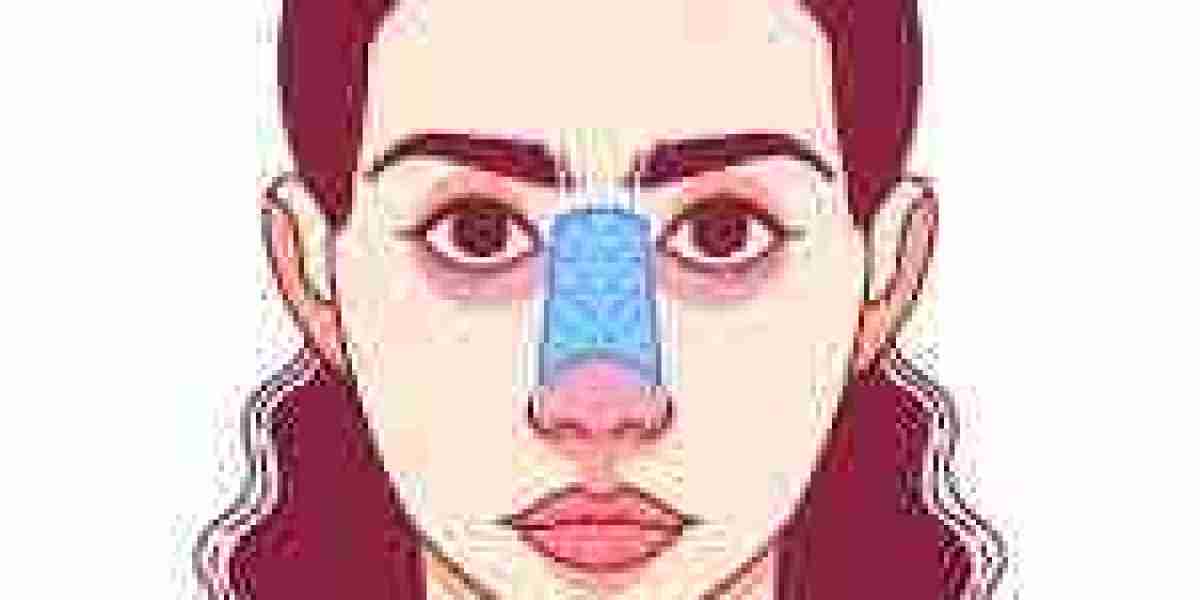 Rhinoplasty Cost in Delhi