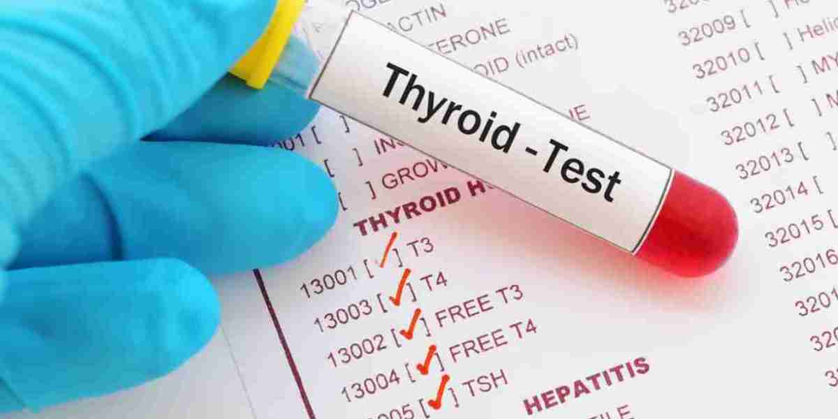 Thyroid Function Test Market: Overcoming Hindrances and Exploring Emerging Demand Trends