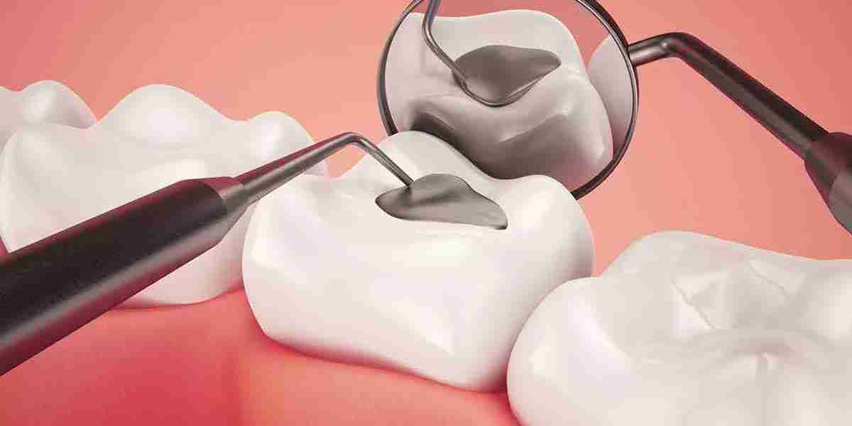 Dental Sealants Market: Rising Demand in Preventive Dental Care