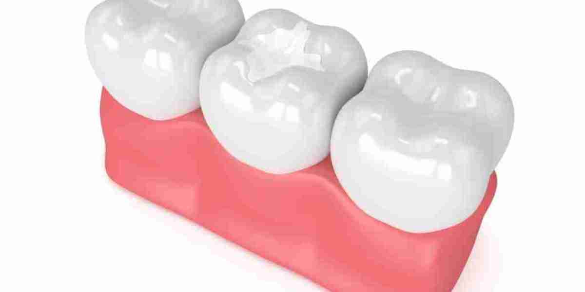 Tooth Filling Materials Market Forecast: Key Market Drivers, Emerging Opportunities, and Future Trends