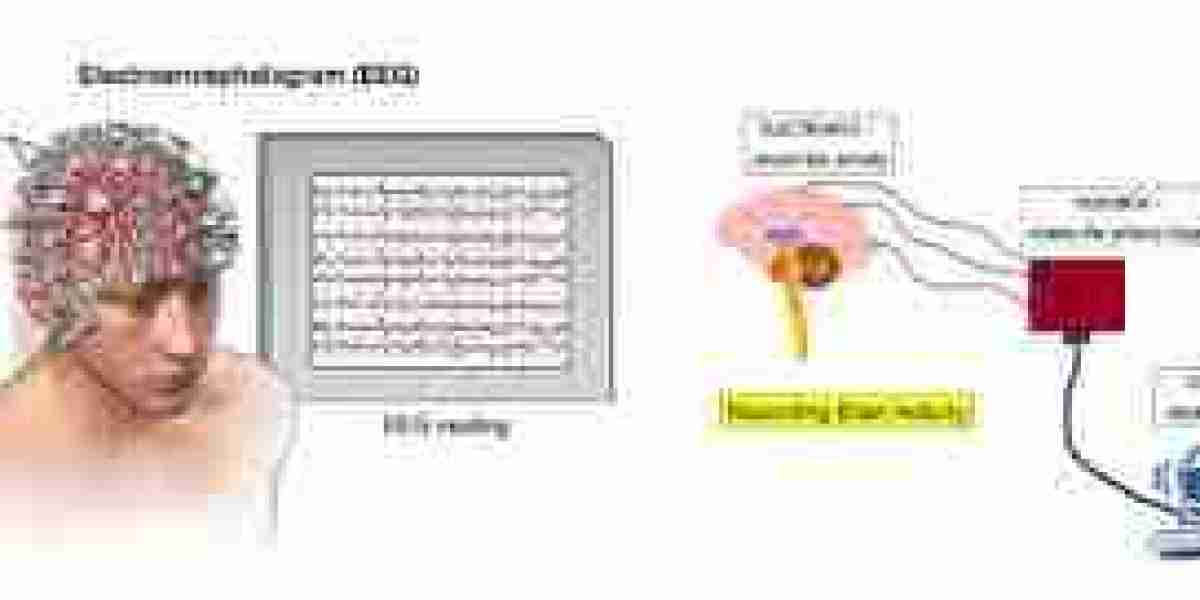 Understanding Electroencephalograms (EEG): A Comprehensive Guide