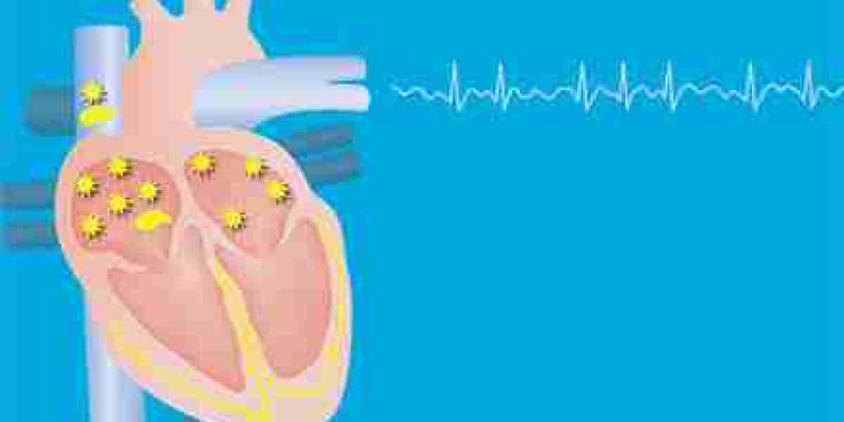 Atrial Fibrillation (Afib) Market Restraints: How High Costs and Complications Affect Global Healthcare Adoption