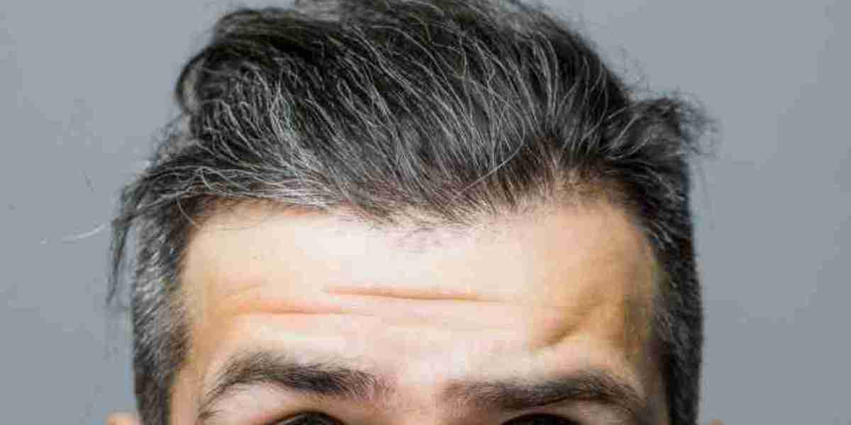 Revealing the Truth Behind Hair Systems for Men: A Complete Guide