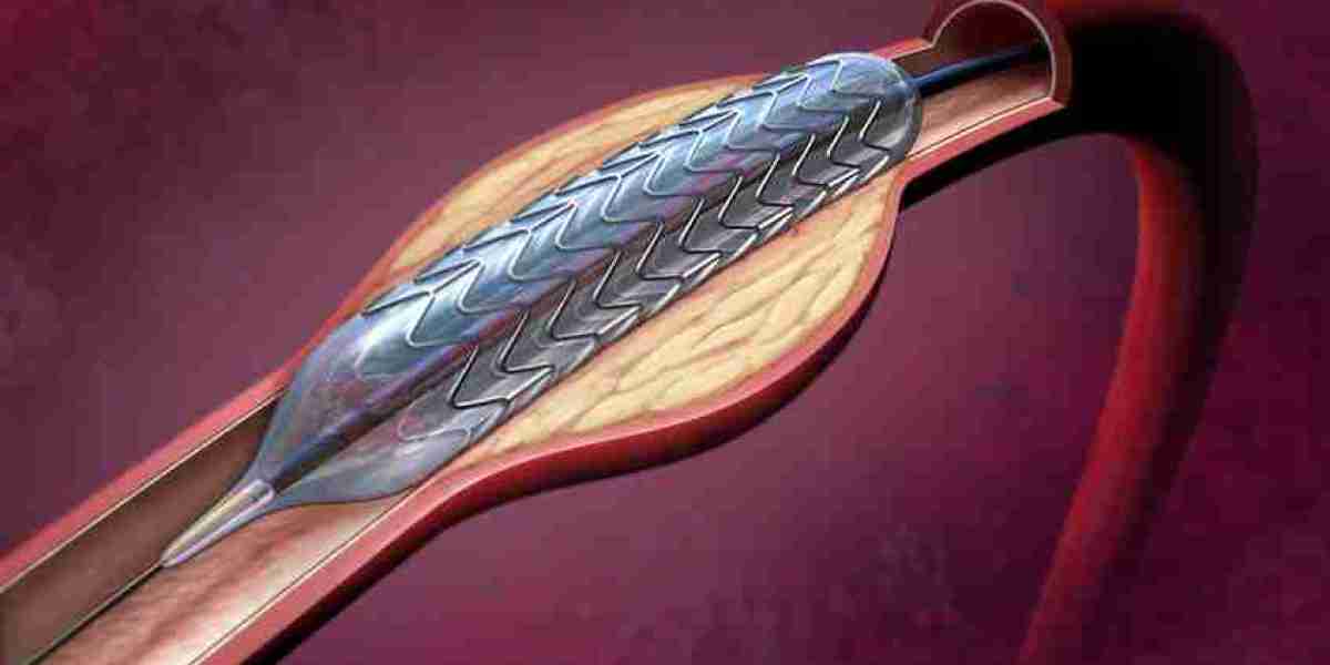 Angioplasty Balloons Market Expansion Due to Minimally Invasive Procedures