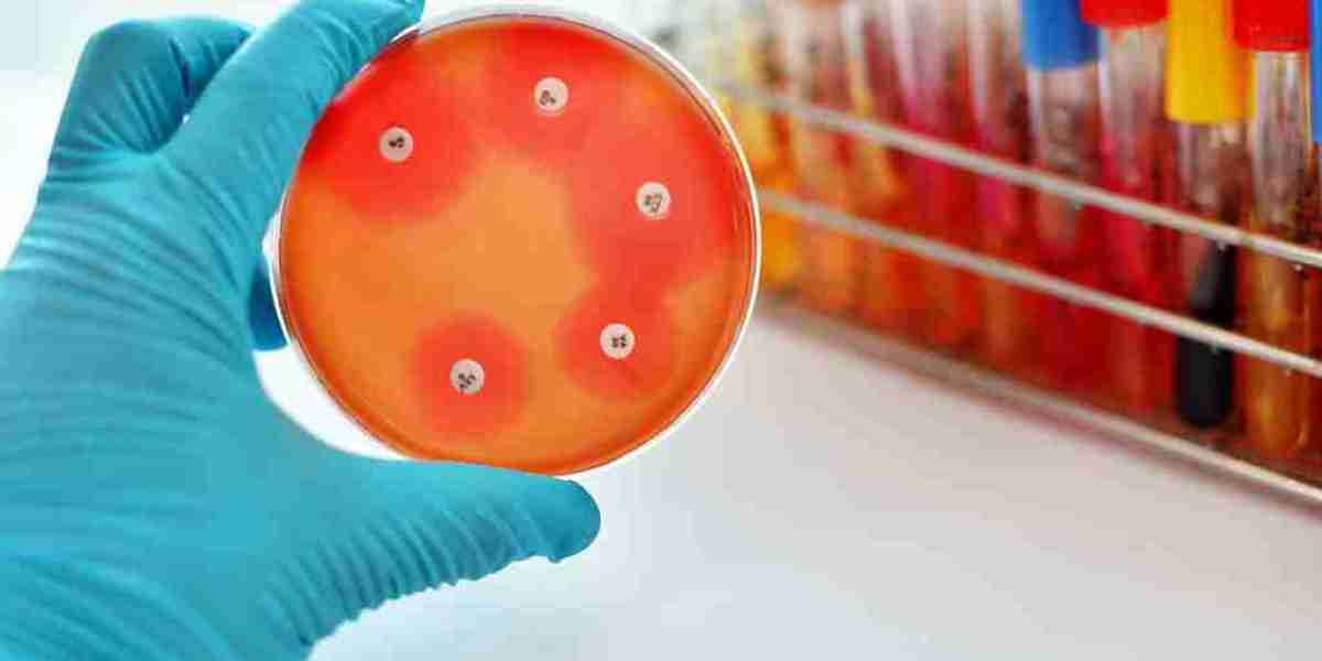 Antimicrobial Susceptibility Test Market Growth Boosted By Advanced Technologies And Global Health Initiatives