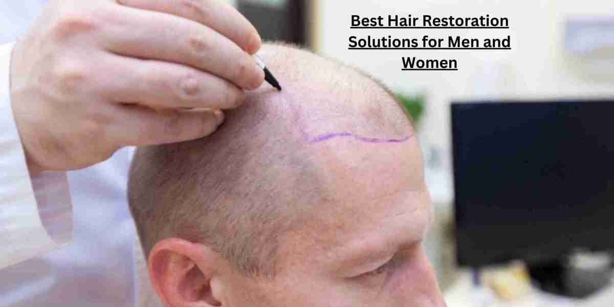 Best Hair Restoration Solutions for Men and Women