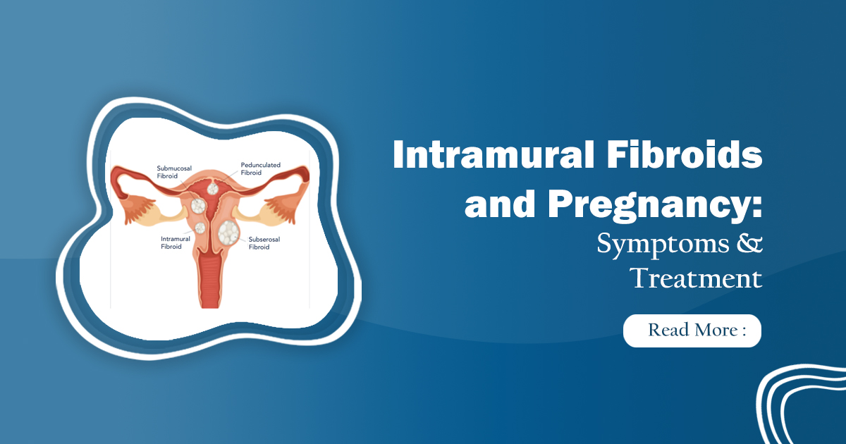 Intramural Fibroids and Pregnancy: Symptoms & Treatment