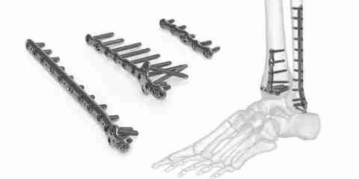 Bone Fixation Plates Market Restraints: Overcoming Challenges to Drive Future Growth and Innovation