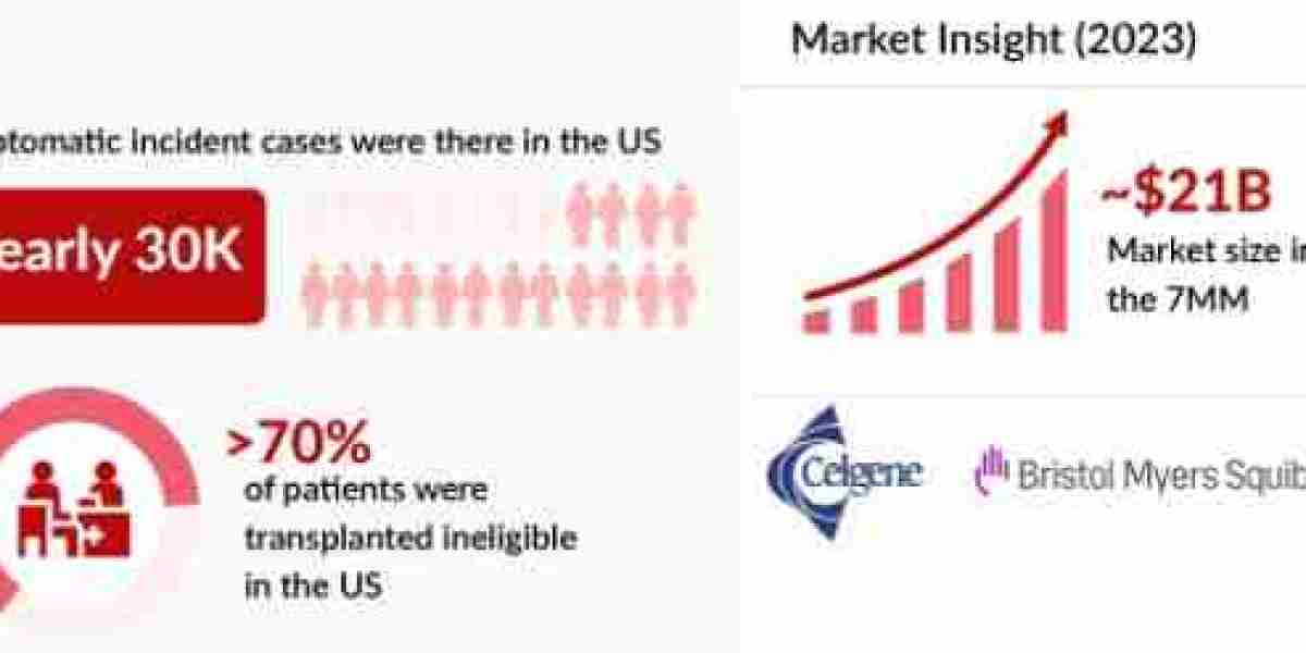 High-Risk Smoldering Multiple Myeloma: Bridging the Gap Between MGUS and Full Multiple Myeloma