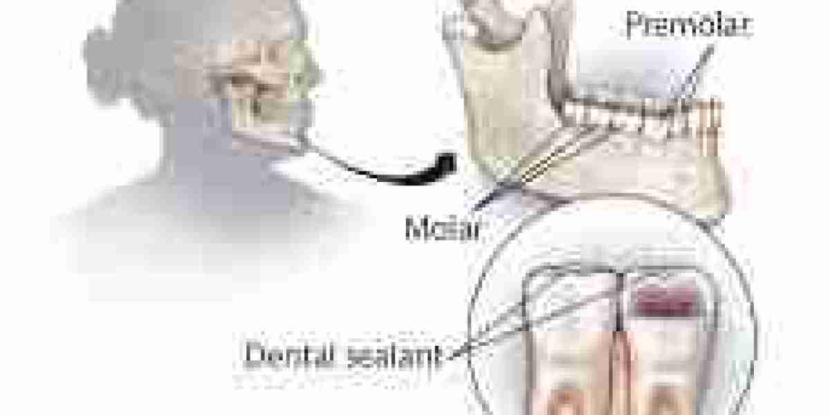 Dental Sealants Market Growth Challenges: Regulatory Hurdles, High Costs, and Consumer Awareness Issues