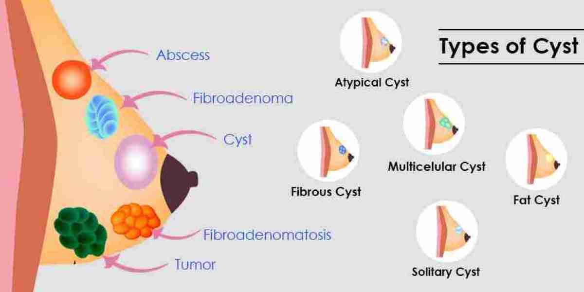 Biopsy for Diagnostic Purposes: Safe and Effective