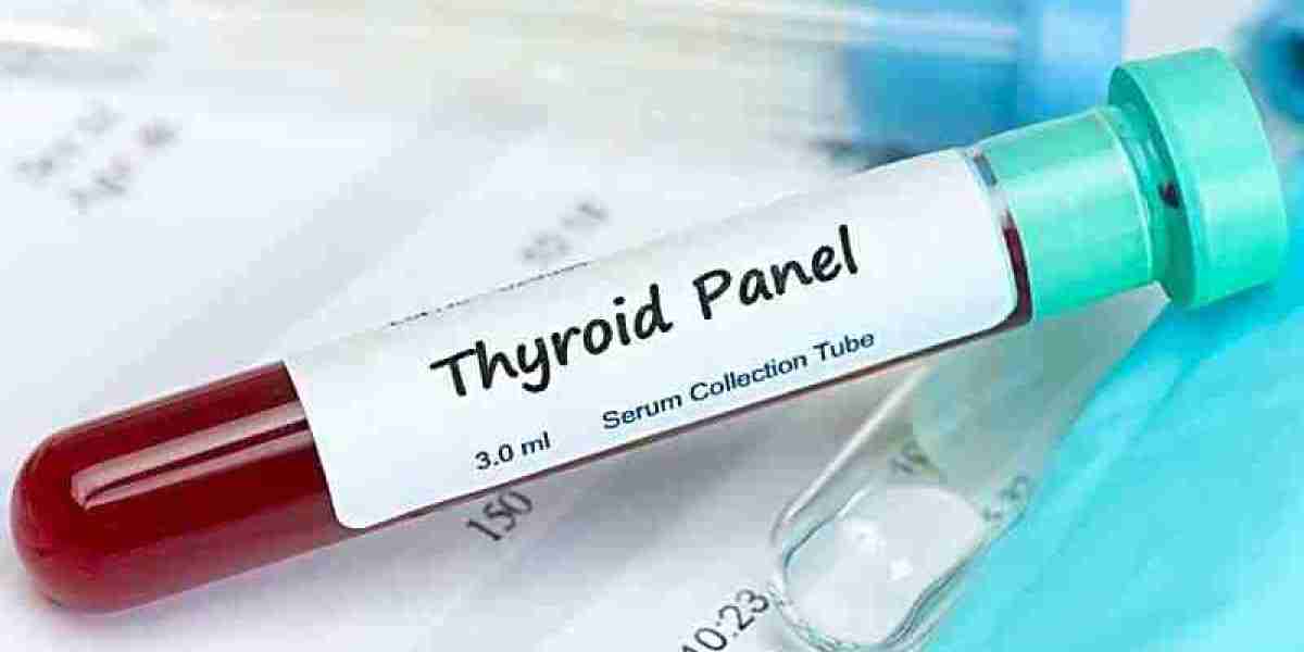 Thyroid Function Test Market Growth Projections and Future Developments in Healthcare Sector