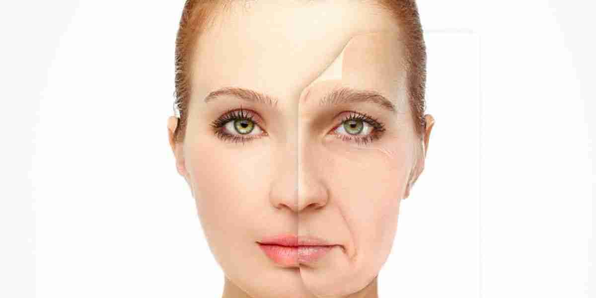 Facelift in Your 50s: Is It Too Late?