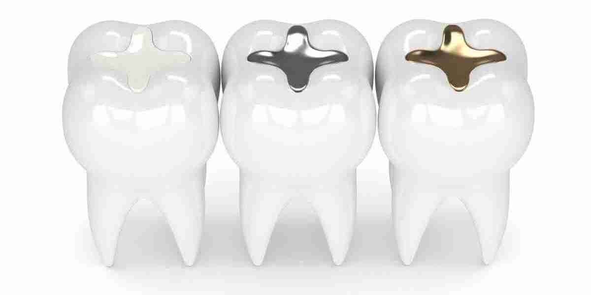 Tooth Filling Materials Market Shifts Redefining Aesthetic Preferences And Technological Advancements Worldwide