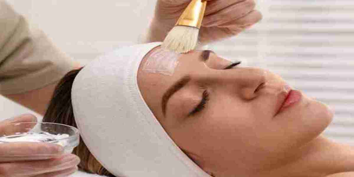 Why Chemical Peeling is the Best Solution for Sun Damage