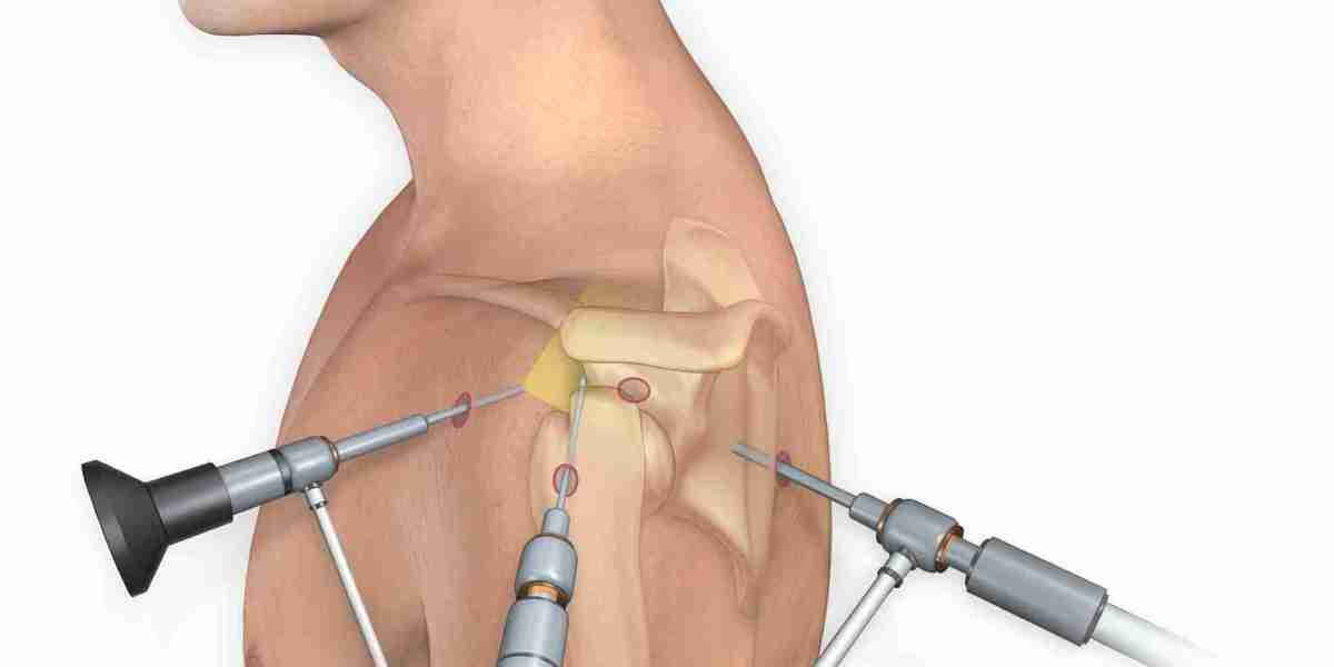 Arthroscopy Devices Market Growth Strengthens Due To Rising Sports Injuries And Orthopedic Disorders