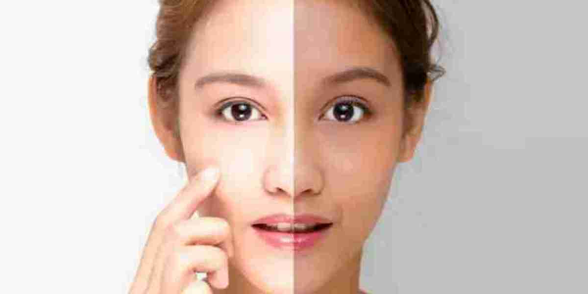 Get Bright Skin on a Budget in Dubai: Affordable Whitening Options