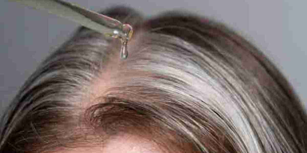 Can Exosomes Stop Hair Loss? Riyadh Finds Out