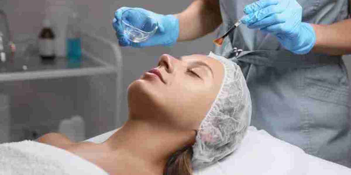 Chemical Peels for Oily Skin: Dubai Treatments That Work