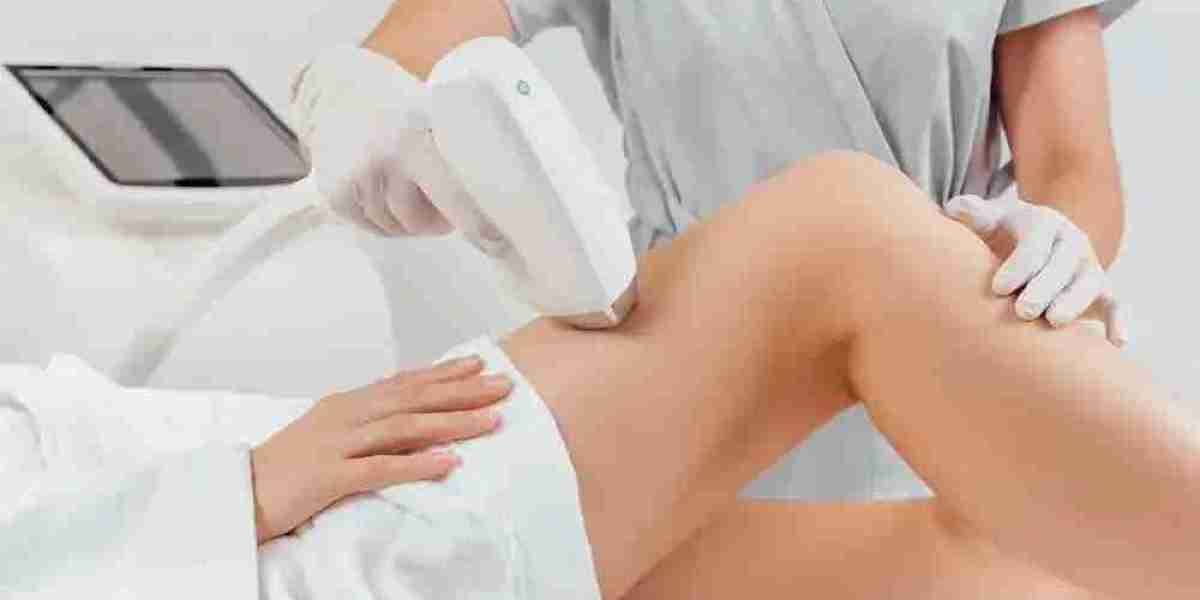 Full Body Laser Hair Removal Frisco – Sleek Laser Solutions
