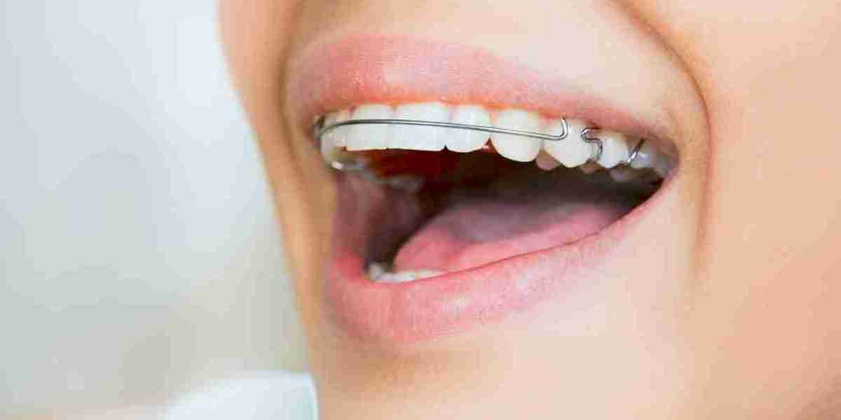 Why Do Orthodontists Recommend Wearing a Retainer?