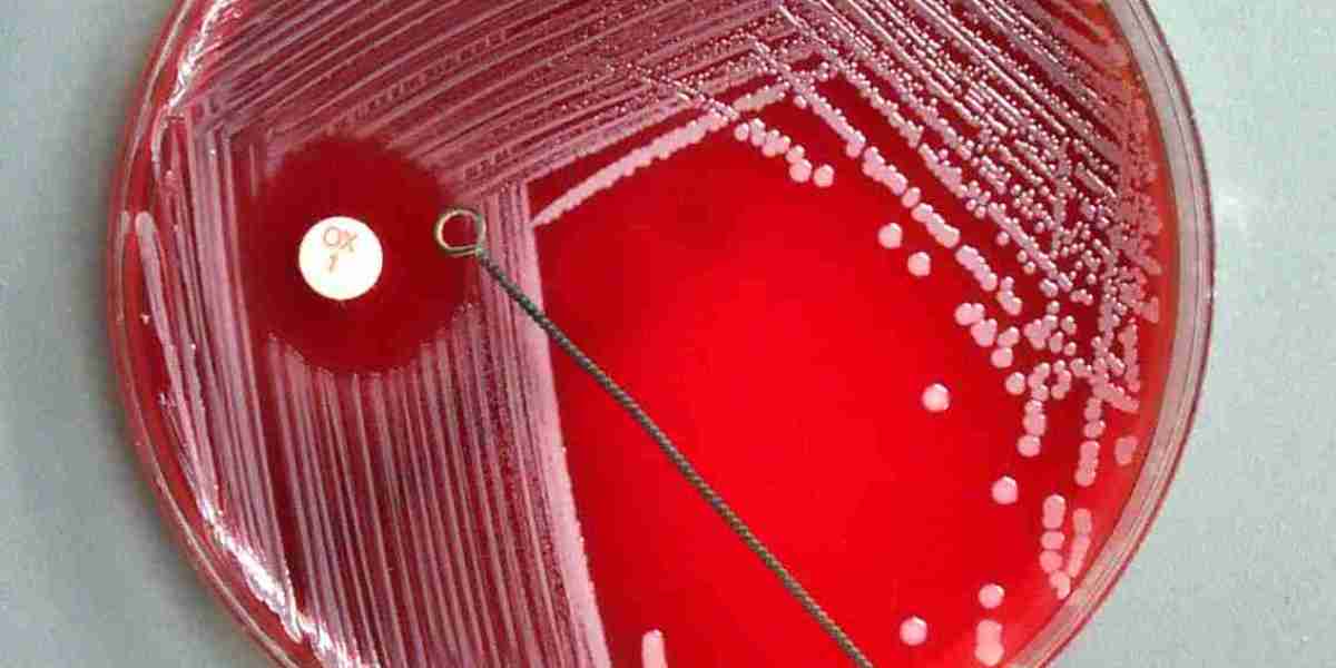 Antimicrobial Susceptibility Test Market Potential Fueled by Technological Advancements in Diagnostic Tools and Testing 