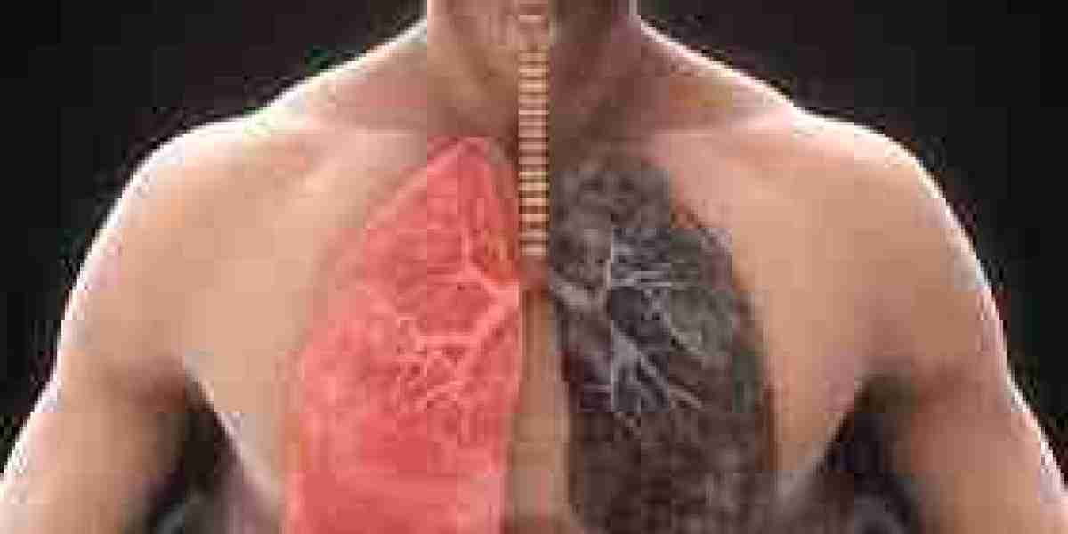 Chronic Obstructive Pulmonary Disease (COPD) Market : Key Drivers, Regional Insights & Forecast to 2033