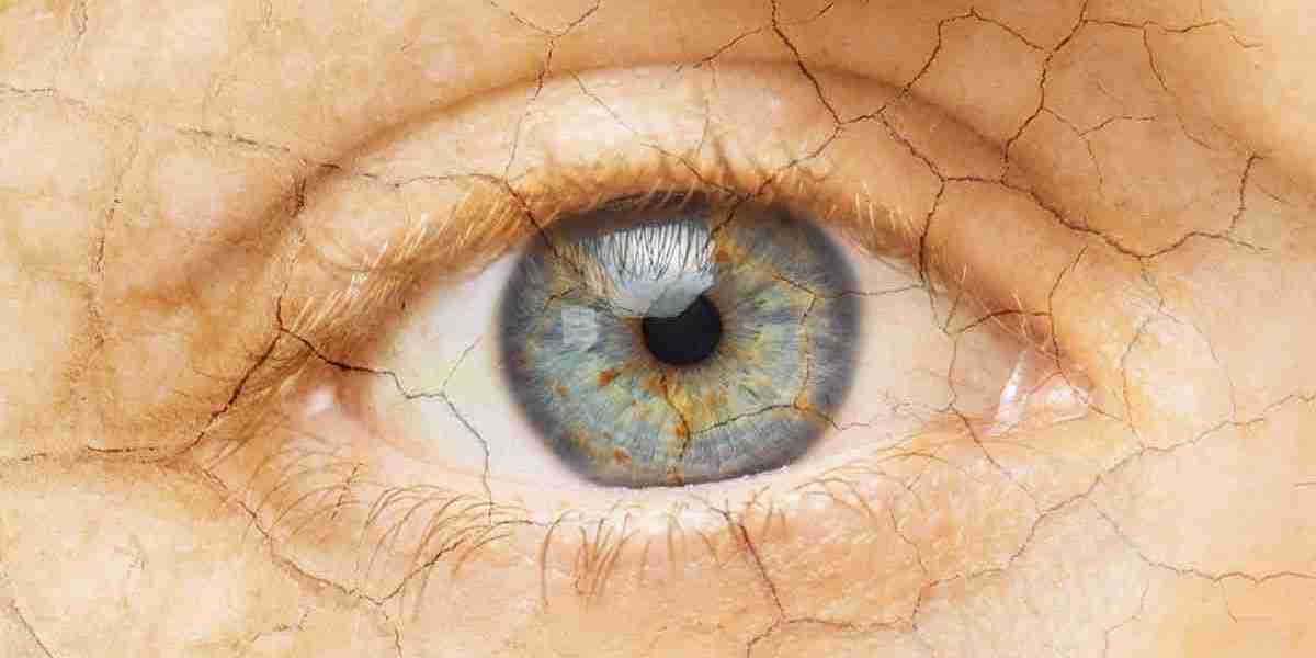 Dry Eye Syndrome Market: Impact of Screen Time, Lifestyle Changes, and Rising Treatment Demands