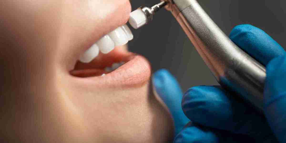 Teeth Whitening After Braces, Is It Safe?