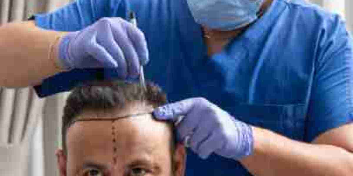 عيادات زراعة الشعر المعتمدة في الرياض بأفضل الأسعار