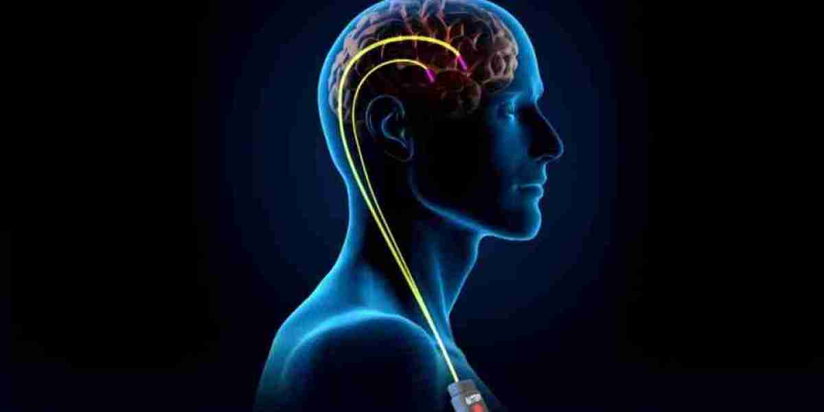 Deep Brain Stimulation Market Growth Opportunities and Forecast by 2030