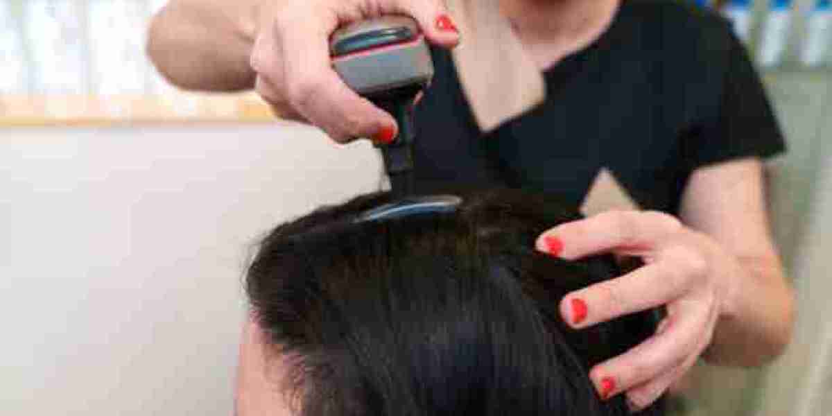 هل زراعة الشعر في الرياض توفر نتائج دائمة؟