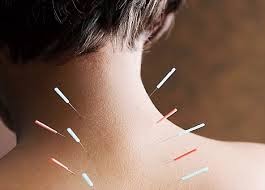 Ancient approaches to balancing energy and health ~ Harmony physiotherapy & health Clinic