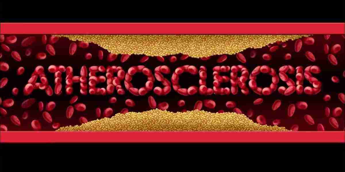 Atherosclerosis Drugs Market Study Shows Preference Shift Toward Biologics Over Traditional Synthetic Drug Options