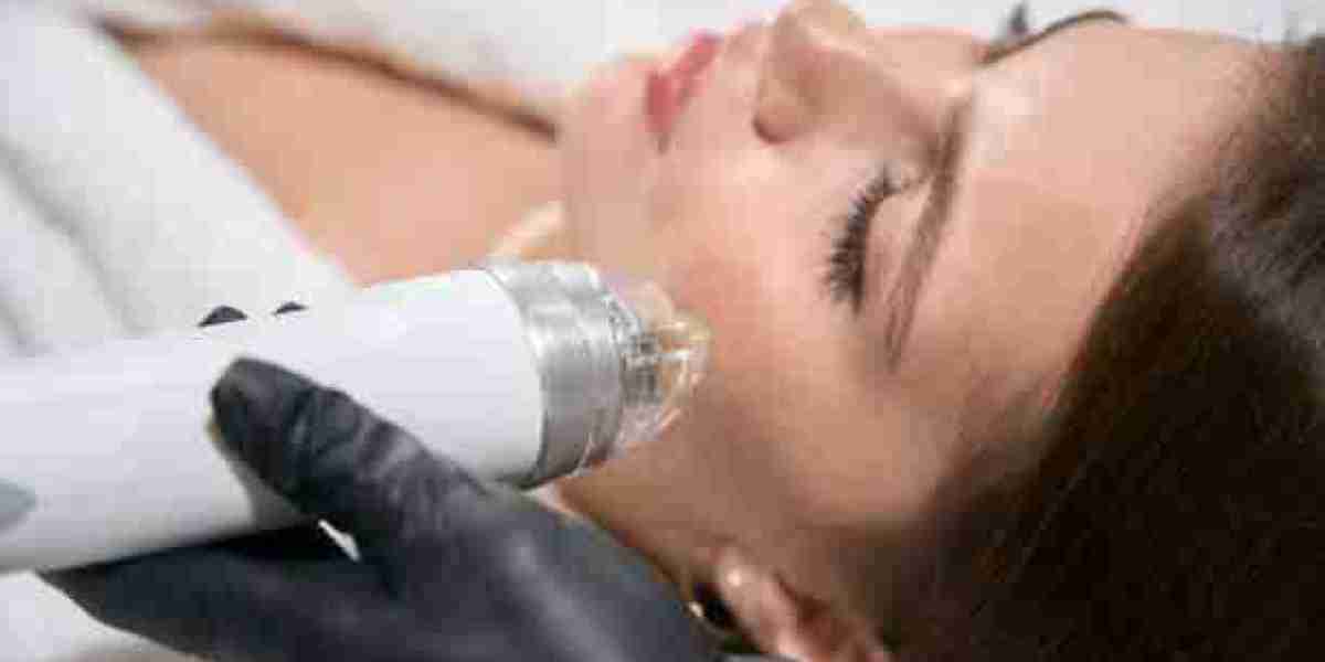 Chemical Peels in Riyadh: Types & Results