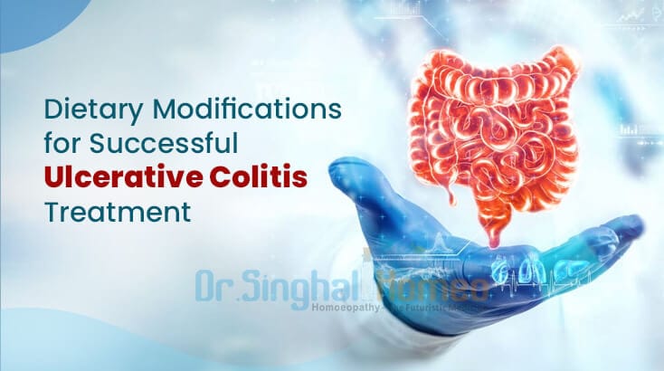 Dietary Modification for Successful Ulcerative Colitis Treatment
