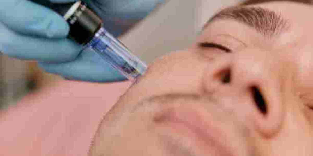 Derma Pen for Acne Scars: The Ultimate Skin Solution