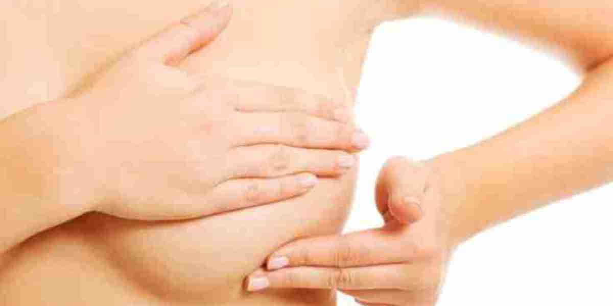 Breast Cysts Treatment: Riyadh Patient Tips