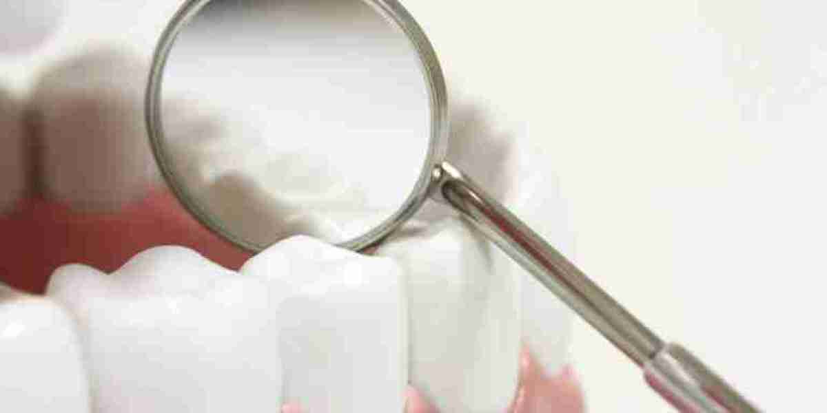 Dental Sealants Market: Emerging Opportunities in Public Health Campaigns and Preventive Dentistry