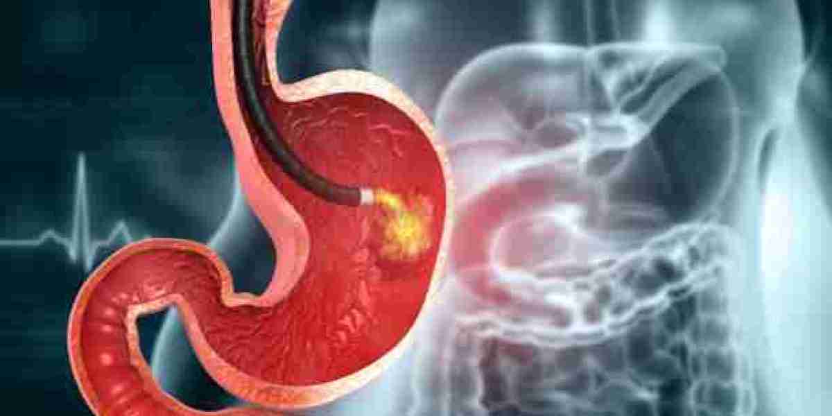Get the Best Results with Gastric Balloon in Riyadh